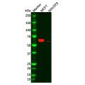 Recombinant Estrogen Receptor alpha Antibody