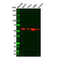 Estrogen Receptor beta Antibody