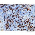 Fascin Mouse mAb