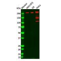Fatty Acid Synthase Mouse mAb
