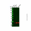 Recombinant Ferritin Antibody