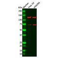 Recombinant FGFR3 Antibody