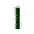 Recombinant FGR Antibody
