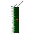 Fibrinogen beta chain Mouse mAb