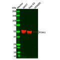 Recombinant FOXA1 Antibody