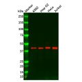 gamma Actin Antibody