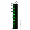 Recombinant gamma Sarcoglycan Antibody
