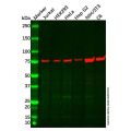 Recombinant GARS Antibody