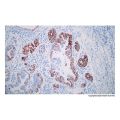 Recombinant Gastric Mucin/MUC-6 Antibody