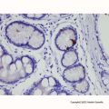 Gastrin Mouse mAb