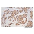 Recombinant GCDFP 15 Antibody