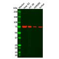 Recombinant GFPT1 Antibody