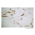 Recombinant Glycophorin A Antibody