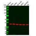 Recombinant GNB2 Antibody