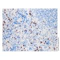 Recombinant Granzyme B Antibody