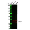 GTF2E2 Antibody