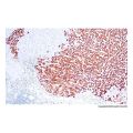 Recombinant Hepatitis B Virus Surface Antigen (Ad/Ay) Antibody