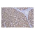 Recombinant Hepatocyte Specific Antigen Antibody