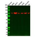 Recombinant Hexokinase 1 Antibody