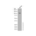 Recombinant HIF-1 alpha Antibody