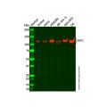 Recombinant HIP1 Antibody