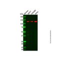 HIP1R Antibody