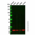 Histone H3 (tri methyl K4) Antibody