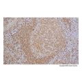 Recombinant HLA-DR Antibody