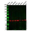 IFN gamma Receptor beta/AF-1 Antibody