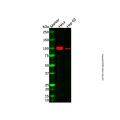 Recombinant Insulin Receptor Antibody