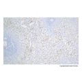 Recombinant Integrin beta 3 Antibody