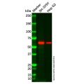 KCNC1 Antibody