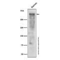 Recombinant Ki67 Antibody