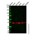 Recombinant Lactate Dehydrogenase A/B/C Antibody