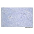 Recombinant Lambda Light chain Antibody