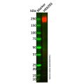 Recombinant Laminin gamma 1 Antibody