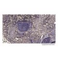 LASP1 Antibody