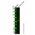 Recombinant LCAT Antibody