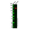 LMTK2 Antibody