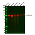 Recombinant LYRIC/AEG1 Antibody