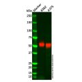 Recombinant MAGEC2 Antibody