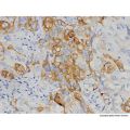 Mammaglobin A Mouse mAb
