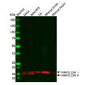 Recombinant MAP1LC3A Antibody