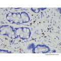 Mast Cell Tryptase Mouse mAb