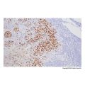 Recombinant Melanoma gp100 Antibody