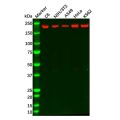 Recombinant MET Antibody