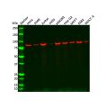 Recombinant MLH1 Antibody