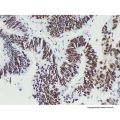 MSH6 Mouse mAb