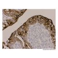 Recombinant MUC1 Antibody