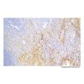 Recombinant MUC1 Antibody